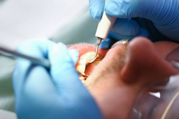 Best After-Hours Emergency Dentist in Port Royal, SC