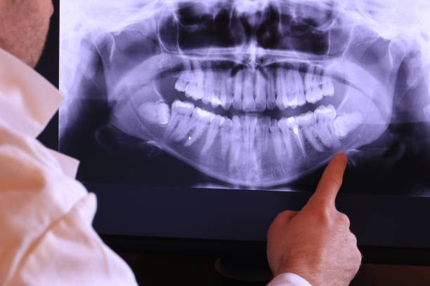 Best Emergency Treatment for Toothache in Port Royal, SC
