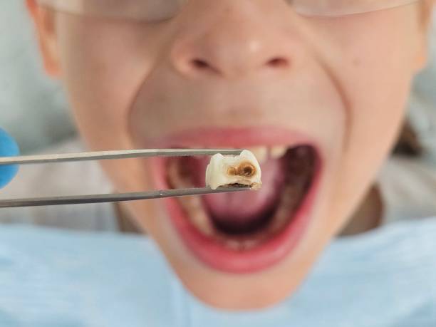 Best Walk-In Emergency Dentist in Port Royal, SC